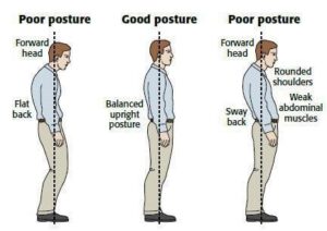 How to Get a Straight Back: Daily Stretches and Core Exercises